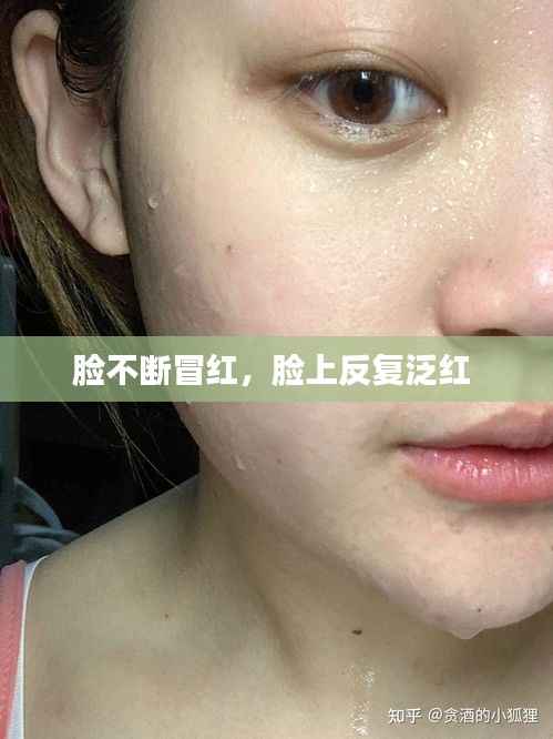 脸不断冒红,脸上反复泛红